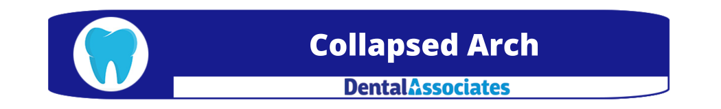 Collapsed Arch